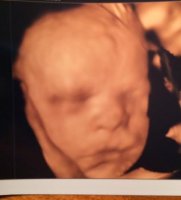 4d baby.jpg
