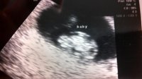 baby 7w4d 080514.jpg