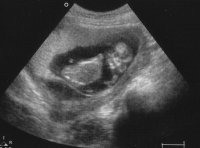babya0805.jpg