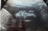 Baby325w1d.jpg