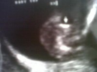 baby%201.jpg