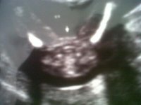 baby%202.jpg