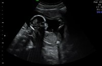 4monthultrasound.jpg