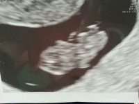 1st Ultrasound.jpg