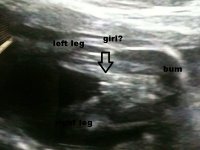 20weeks a009.jpg