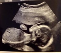 Baby Boy Ultrasound Profile.jpg