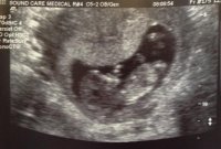 Baby Bean 4.jpg