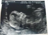 littlesquishy12weeks2.jpg