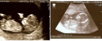 beth-comparing scans.jpg