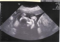 2014-09-08f Ultrasound 23w4d Measuring 23w6d Face Profile.jpg