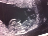 photo-2.jpg