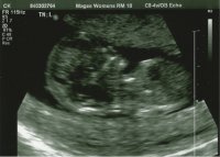 9.12.14 baby.jpg