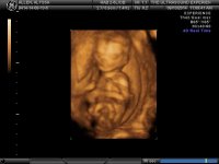 BABY GIRL AT 15 WEEKS_24.jpg