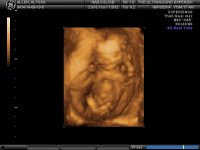 BABY GIRL AT 15 WEEKS_9.jpg