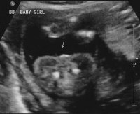 babyb0916 - gender1.jpg