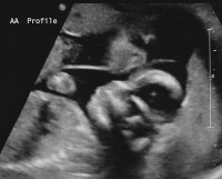 babya0916 - profile1.jpg