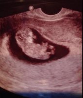 baby profile 10w5d.jpg