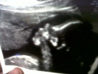 Baby A1.jpg