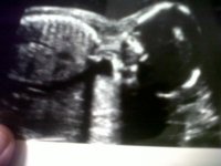 Baby B2.jpg