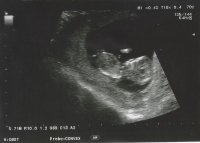 ultrasound no name.jpg