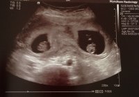9scan_1.jpg
