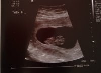 9_scan3.jpg