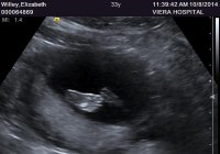 Ultrasound October 8 2014 baby foot.jpg