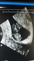 baby8w.jpg