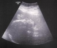 2014-10-09d Ultrasound 28w0d Face Profile.jpeg.jpeg.jpg
