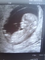 baby2twelveweekscan.jpg