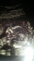 baby#3-14wks.jpg