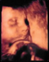 2014-10-22d 3D Ultrasound 29w6d Face Cropped.jpg