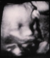 2014-10-22e Ultrasound 29w6d Face Cropped.jpg