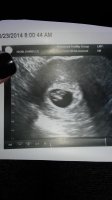 7 week scan.jpg