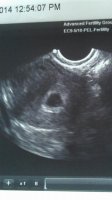 6 week ultrasound.jpg