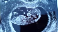 baby11w.jpg