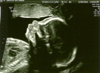 20 week ultrasound0001.jpg