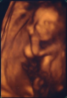 Baby GIRL.png
