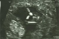 baby3-1.jpg