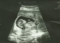 baby13weeks-1.jpg