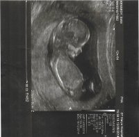 12 Week Scan.jpg