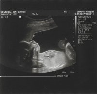 20 Week Scan2.jpg