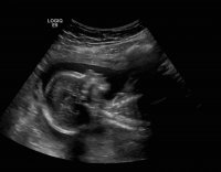 20weeks1.jpg