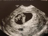 Twins first picture.jpg