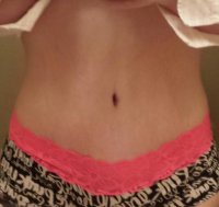 Post surgery front.jpg