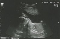 ultrasound no name.jpg