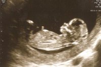 ultrasound12w5dbaby2image2.jpg