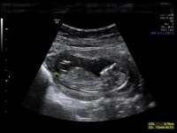 BABY 12 WEEKS_1.jpg