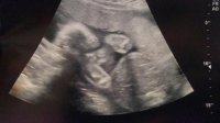 27 week teddy scan.jpg