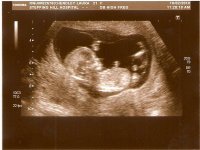 spud number 2 12 weeks scan.jpg